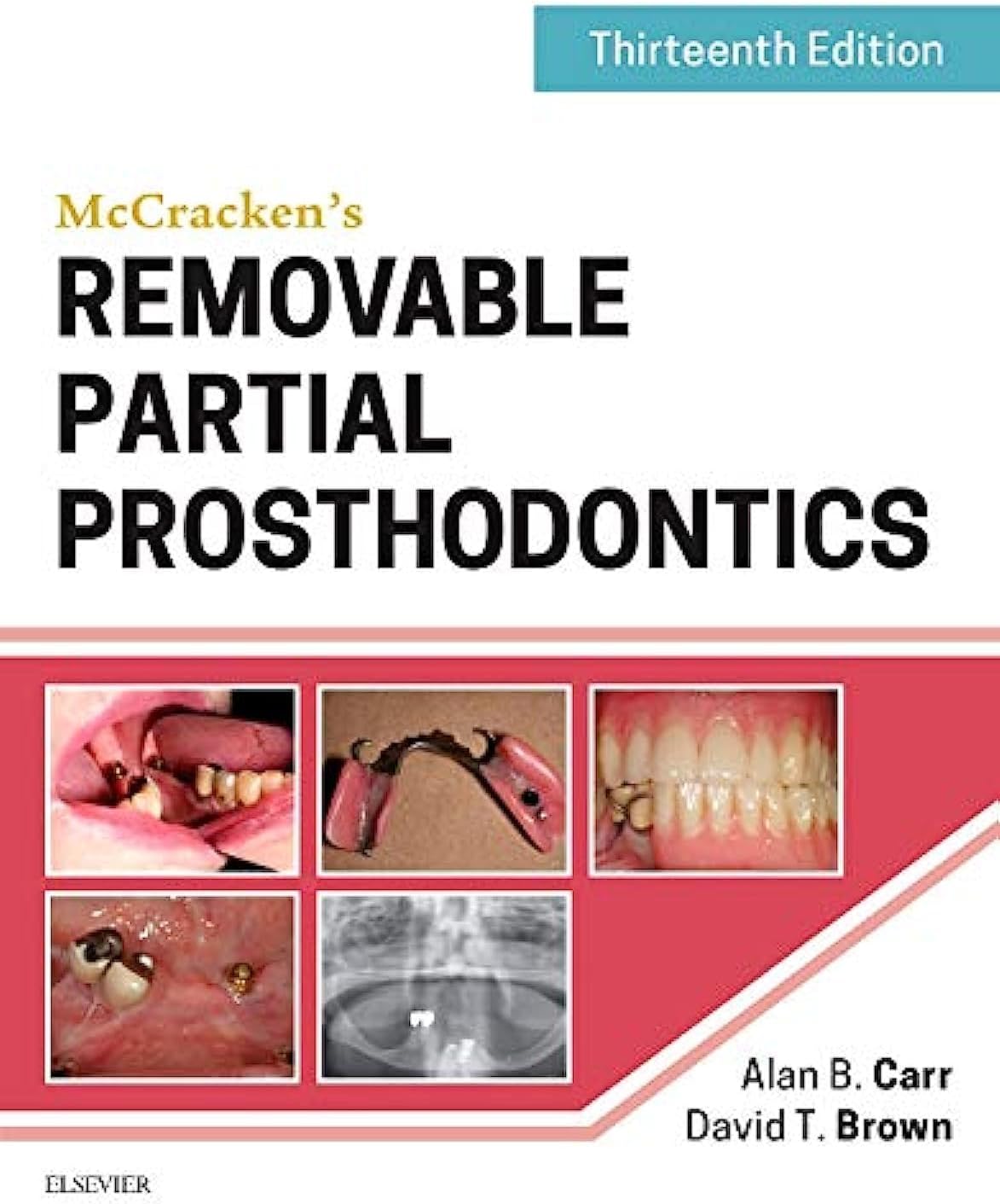 McCracken's Removable Partial Prosthodontics 13th Edition
