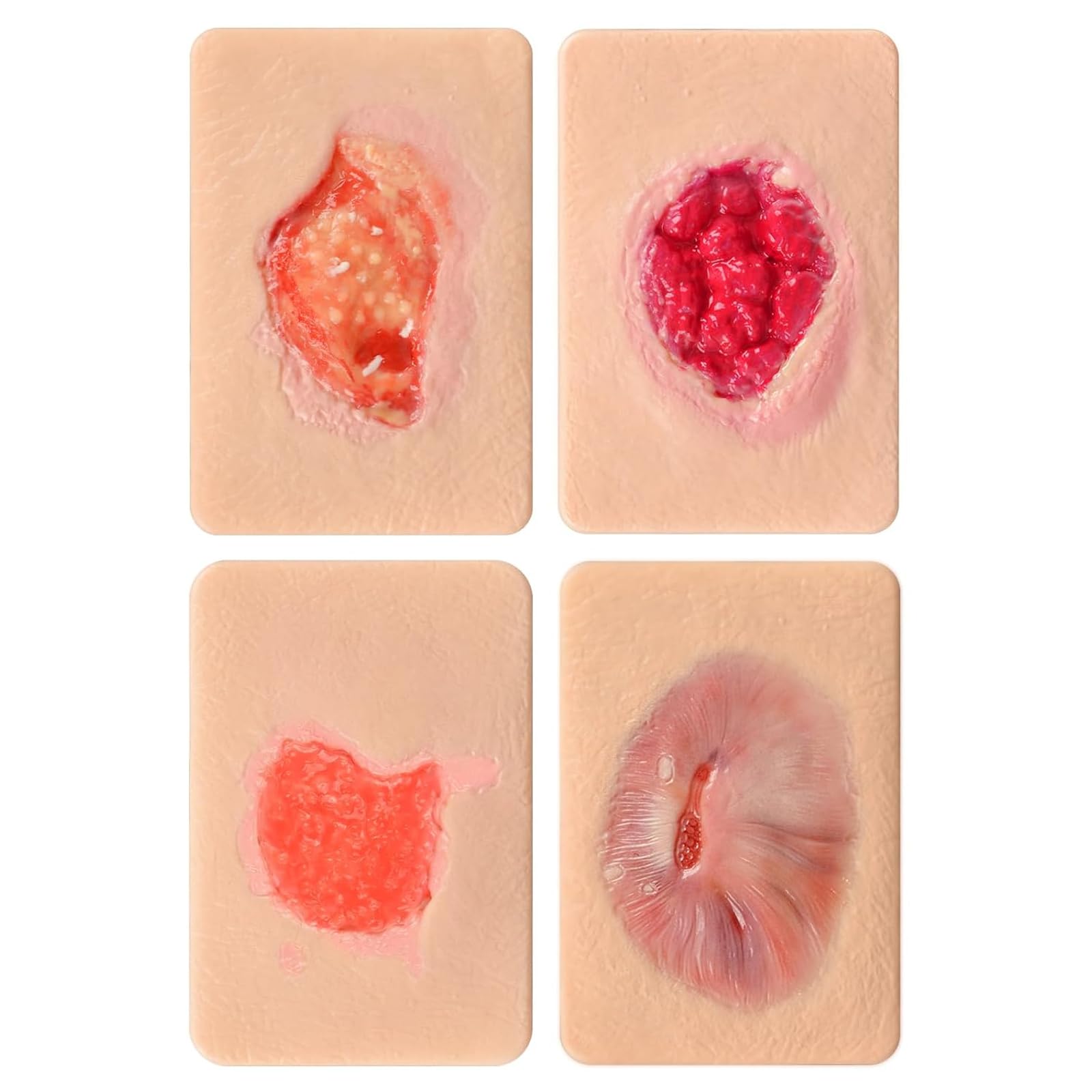 Dispositif De Simulation De Pansement par Granulation (3 Ou 4 Pièces), Modèle De Pansement De La Taille d'une Paume, pour La Formation Médicale Et Les Démonstrations De Soins des Plaies