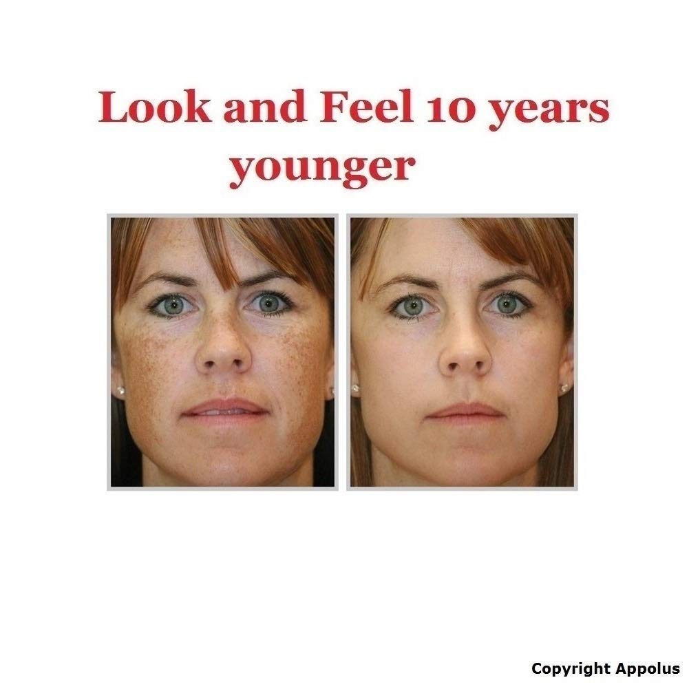 Microdermabrasion Machine - Appolus Premium Diamond Microdermabrasion Skin Rejuvenation & Tightening Kit - Fine Lines & Wrinkles Reducer - Facial Body Massage & Cupping - Hot Compress & 4 Heads : Beauty & Personal Care