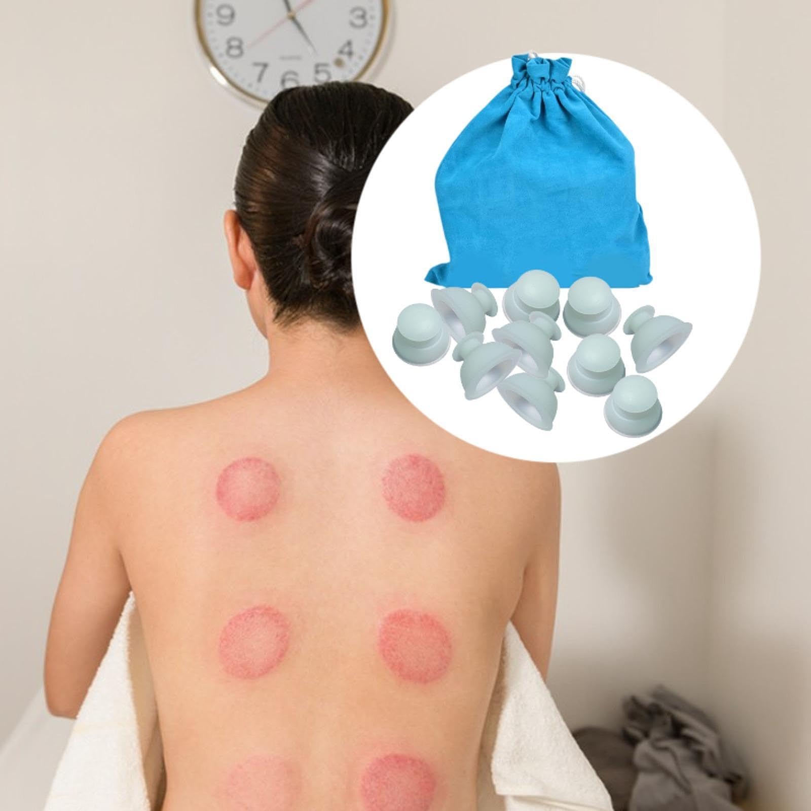Juego de 10 Ventosas de Silicona Profesionales para Masaje con Ventosas de Vacío para Brazos, Relajación Corporal Y Espalda, Blanco