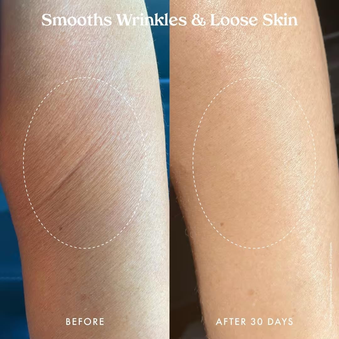 Kopari Ultra Renewal Retinol Body Cream, Infused with Acai & Encapsulated Retinol, Treat Fine Lines & Crepey Skin, Resurface & Boosts Collagen, 4.7 oz image 7 of 7 B0CS4N39RW