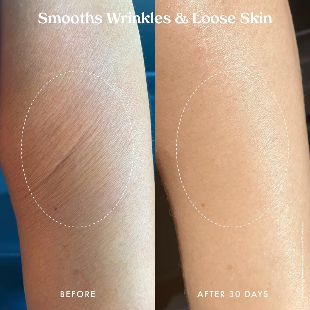 Kopari Ultra Renewal Retinol Body Cream, Infused with Acai & Encapsulated Retinol, Treat Fine Lines & Crepey Skin, Resurface & Boosts Collagen, 4.7 oz - Image 7