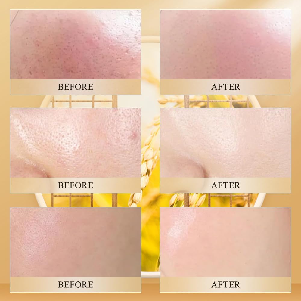 FYeang® Black and White Rice Peel, Peel Shot,Facial Care Essence, Essential Oil Extraction, Cleanse Skin Dead Skin Cells, Blackheads Remover for All Skin Types - Image 2