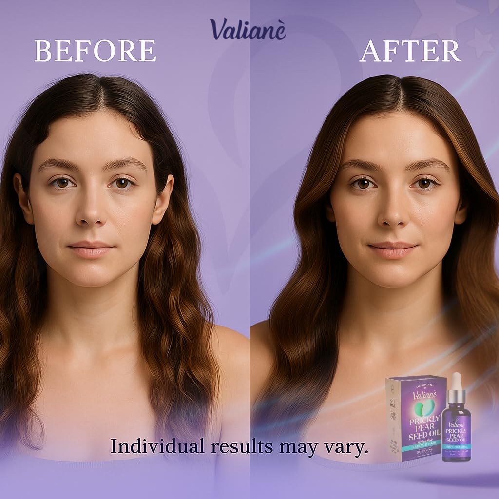 PRICKLY PEAR SEED OIL for FACE & HAIR Premium - Facial Serum Body Moisturizer Beard Oil - Prickly Pear (Barbary Fig) 100% NATURAL Enriched Blend, Extra Virgin Cold Pressed for Dry Skin 1 Fl Oz Valianè