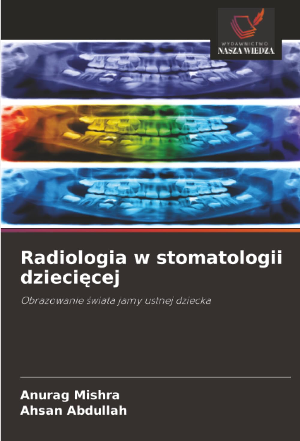 Radiologia w stomatologii dzieci¿cej: Obrazowanie ¿wiata jamy ustnej dziecka