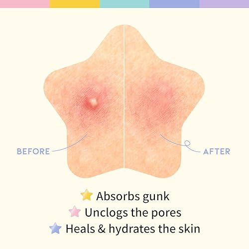 Miniatura 5 de Parche para acnéespinillas para cara, hidrocoloide, niacinamida, ceramida, bonitos colores pastel, protección y curación, evita cicatrices,