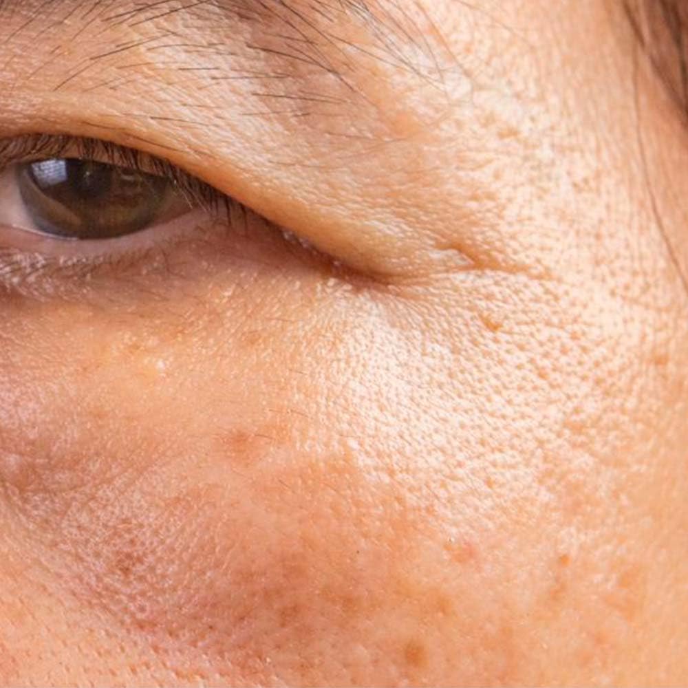 Pack 10 Jabón artesano de Regaliz - Aclara manchas de la piel. Reduce inflamación y enrojecimiento de piel seca. Cara y cuerpo
