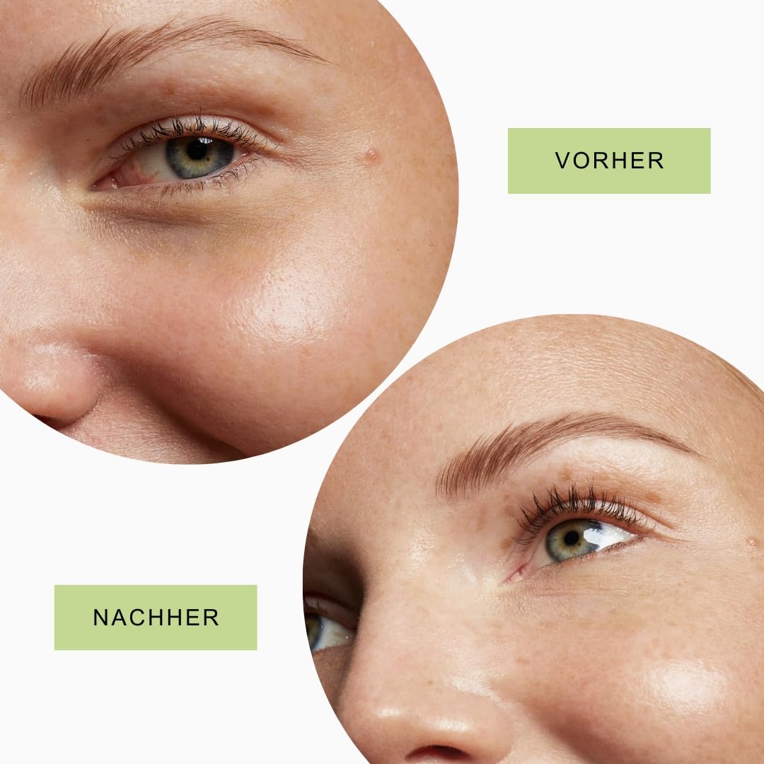 Wiederverwendbare Augenpads + 5ml augen serum – Made In Germany - gegen Anti-Aging, Tränensäcke & Fältchen - Award Winner 2022-100% medizinisches Silikon – The Original Since 2021