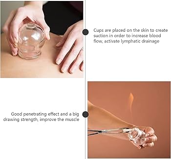 Amazon.co.jp: カッピングセット 吸い玉 真空カッピング ガラス