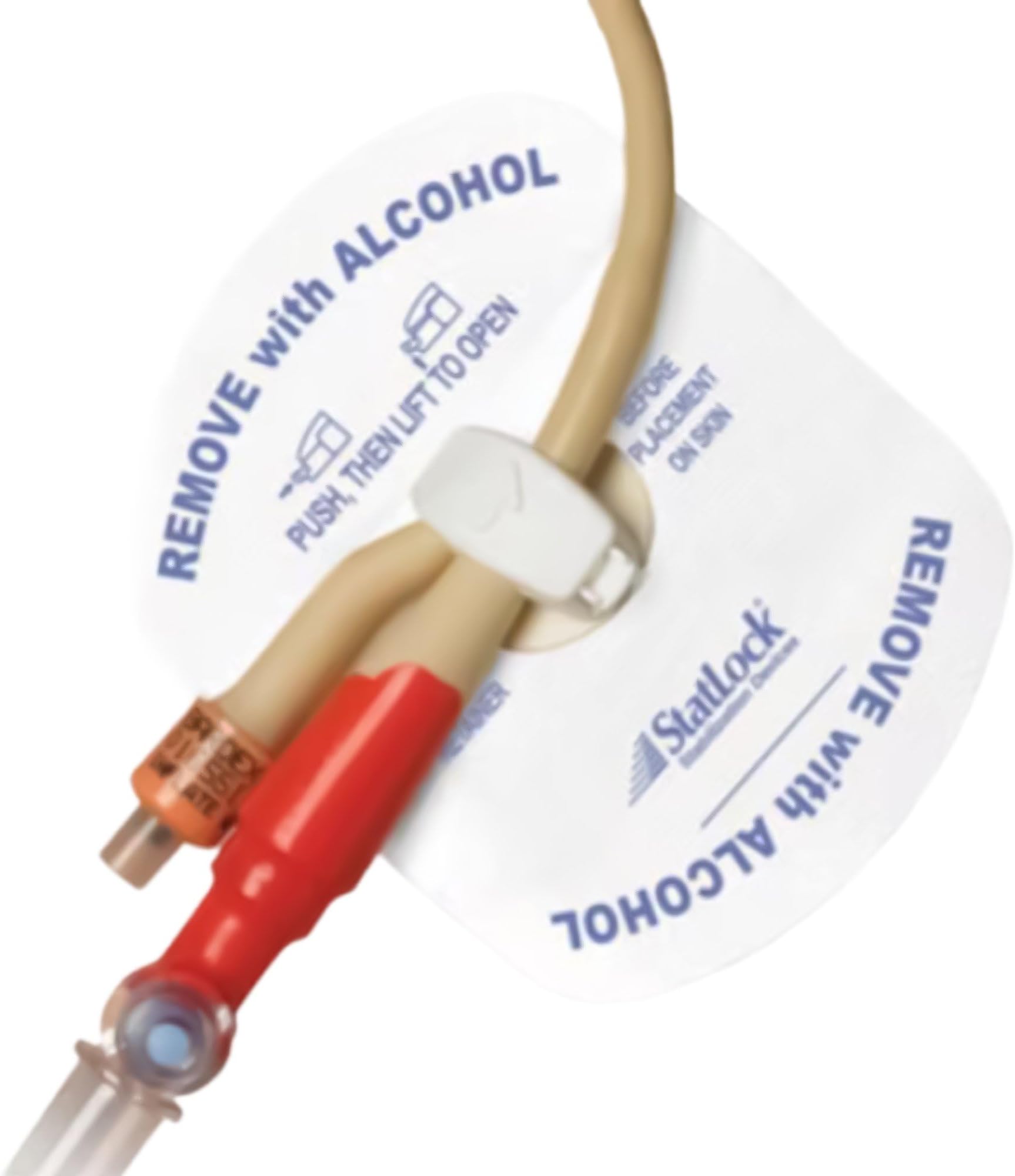 StatLock Pediatric Foley Stabilization Device with Foam Anchor Pad