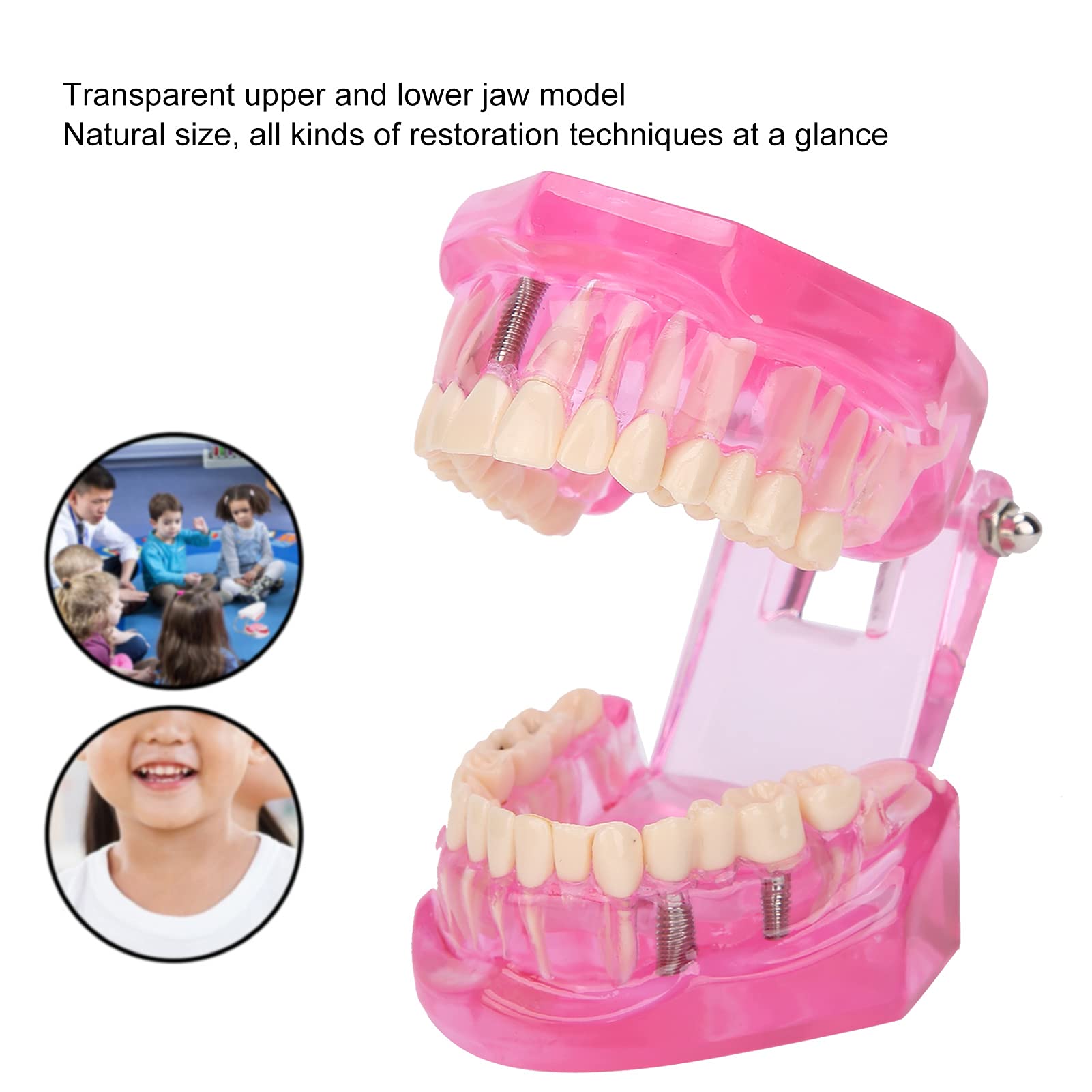 Modello di Denti, Modelli Dentali Per Adulti Trasparenti, Riparazione Studio degli Strumenti in Modalità Denti Dentali, Denti Finti Compatibili Per Insegnamento, Ricerca E Laboratori Odontoiatrici