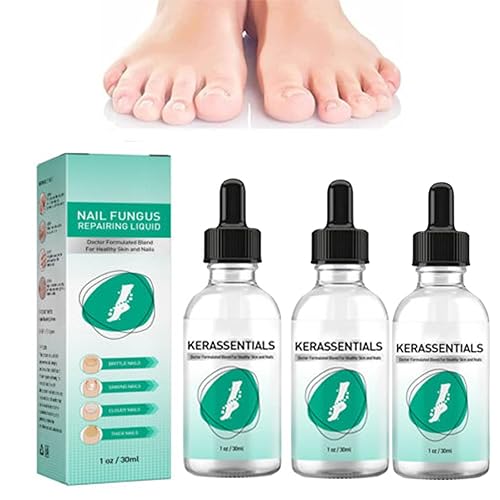 Kerassentials - Tratamiento de hongos en las uñas de los pies, tratamiento de uñas Kerasentials, Kerassentials para hongos en las uñas de los pies,