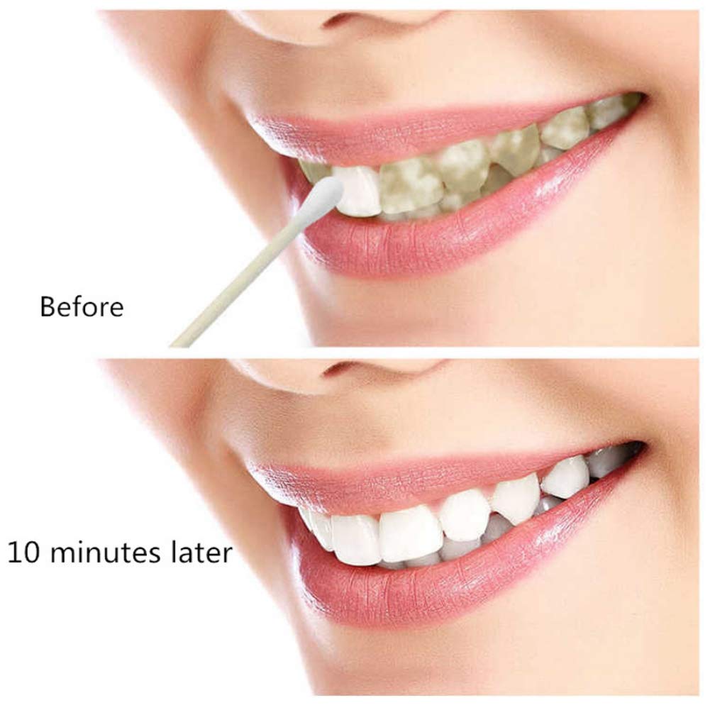 Blanchiment des Dents Essence et Srum, Gel de Blanchiment des Dents Pour  Nettoyer les Dents Blanchissant
