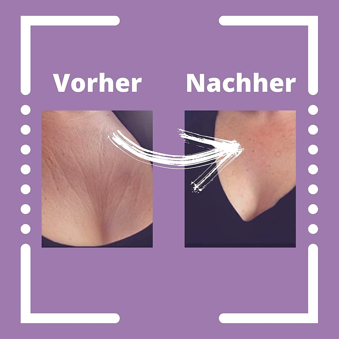 Anti-Falten Schlaf BH I Zur Reduzierung von Falten im Dekolletee I Gegen Brustfalten I Faltenglättende Behandlung über Nacht I Anti Aging Bra I Schwarz
