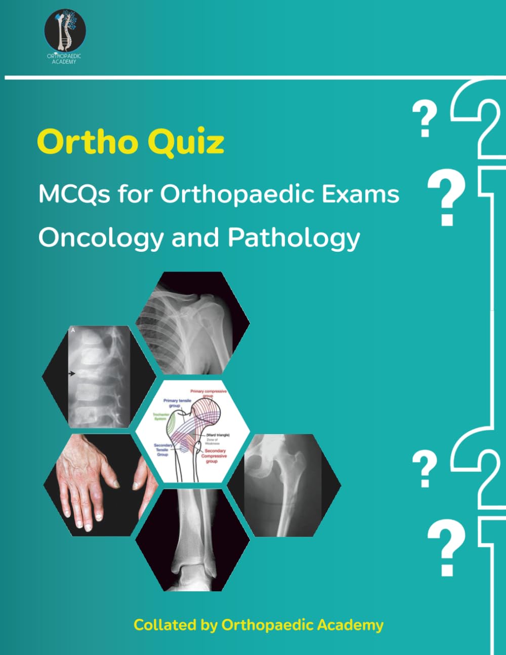 Ortho Quiz: Oncology & Pathology (Concise Orthopaedics)