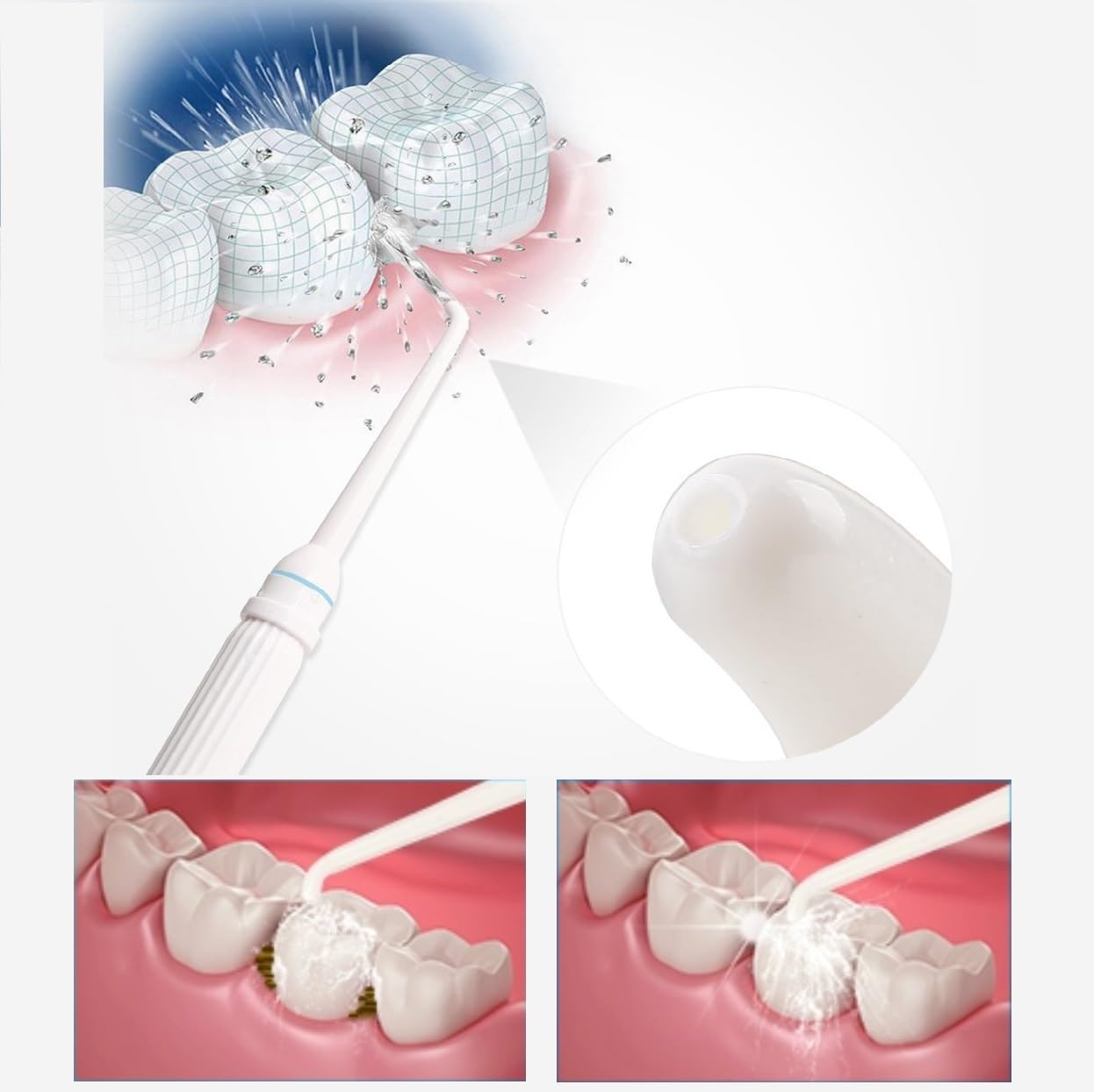 Dental Irrigator Angeschlossen an den Wasserhahn, ohne Batterien und Strom, Wasserpuls Zahnreiniger zur Reinigung von Zähnen und Zahnfleisch