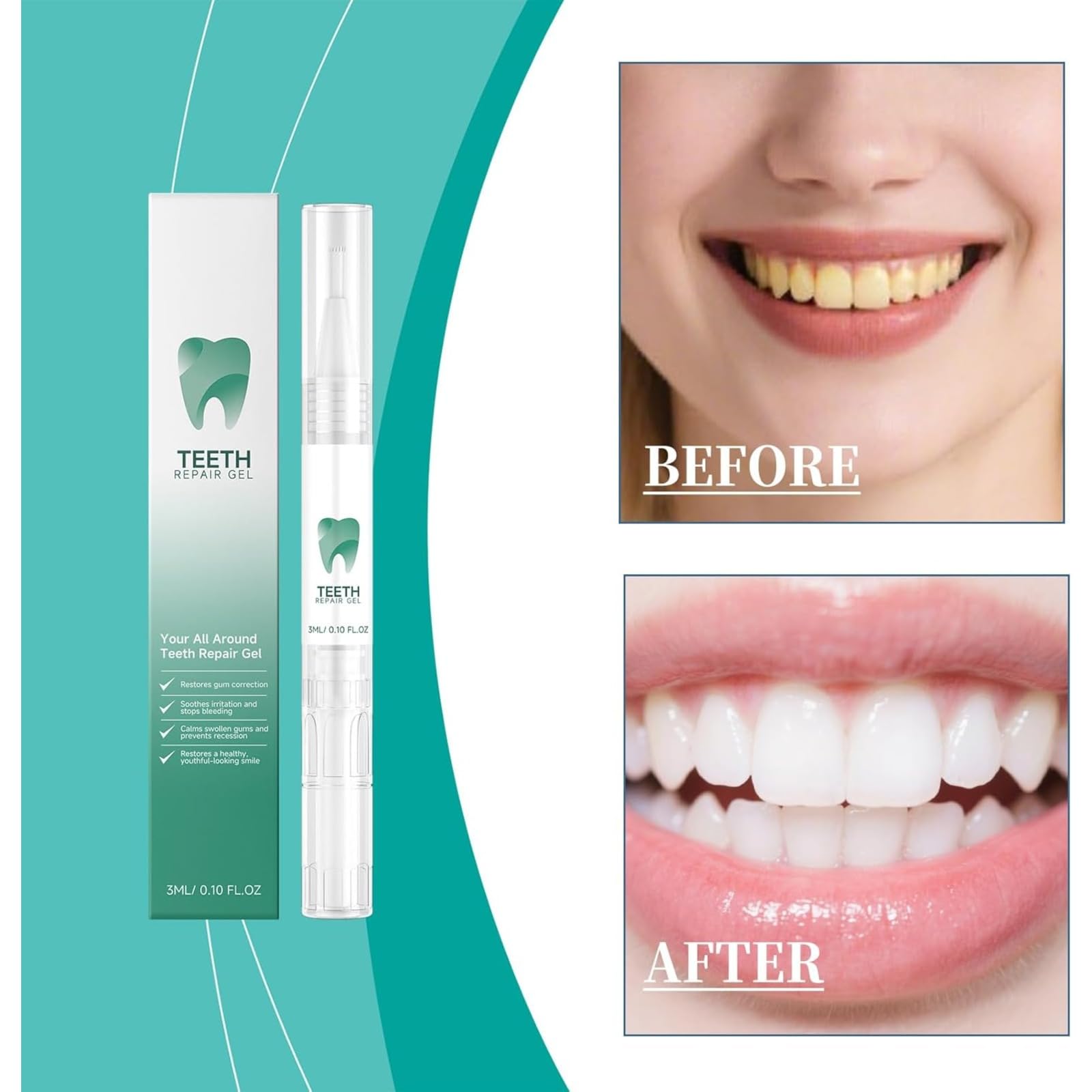 Gel de reparación de dientes, juego de reparación de encías, protector de encías al regresar las encías, lápiz esencial para blanquear los dientes, quitamanchas, limpieza bucal, protección de encías