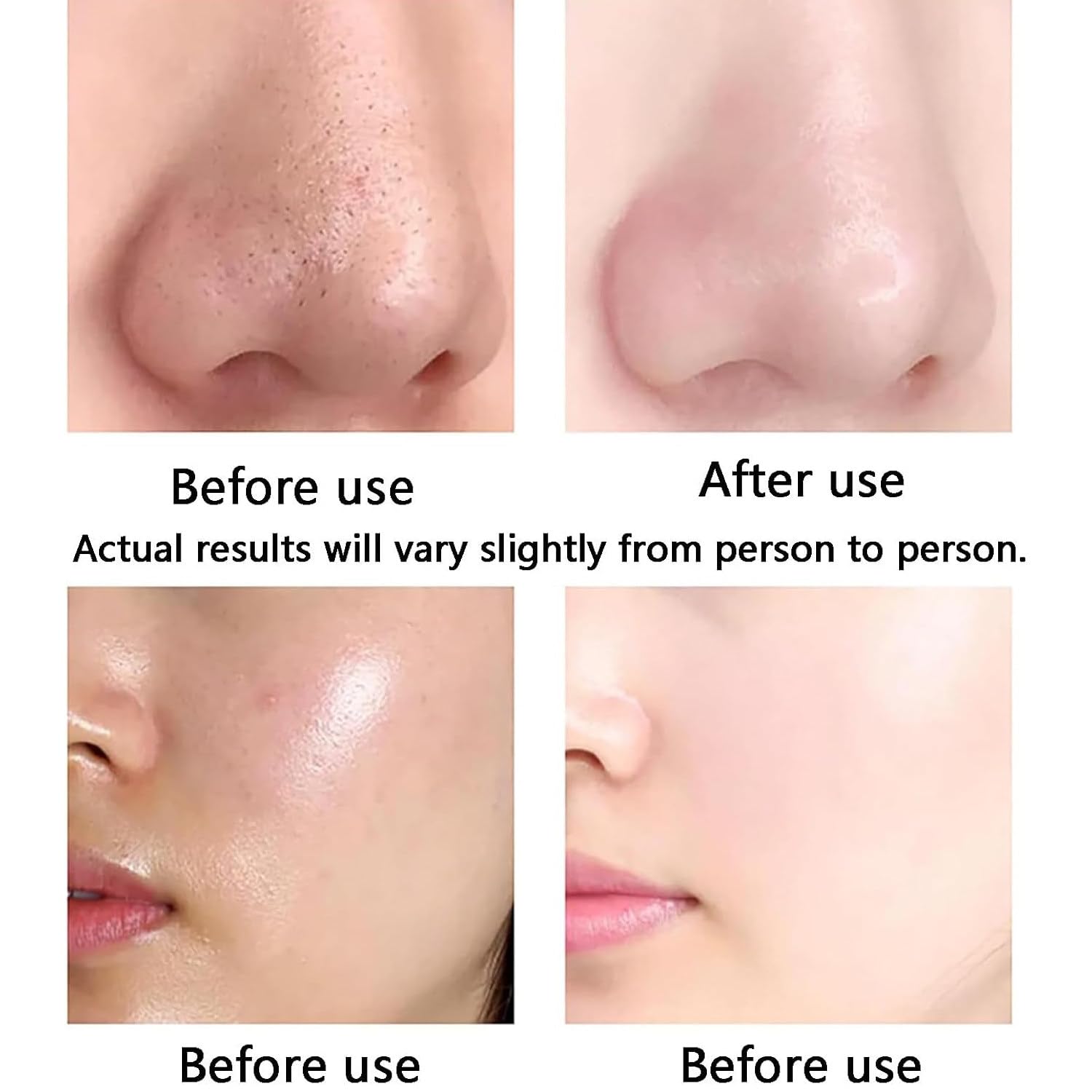 Máquina Hidráulica 10 En 1 Profesional Hydrafacial, Hidrodermoabrasión para Limpieza Profunda Exfoliante, Hidratante Facial con Pantalla LED,Dispositivo Aqua Rejuvenecimiento De Piel