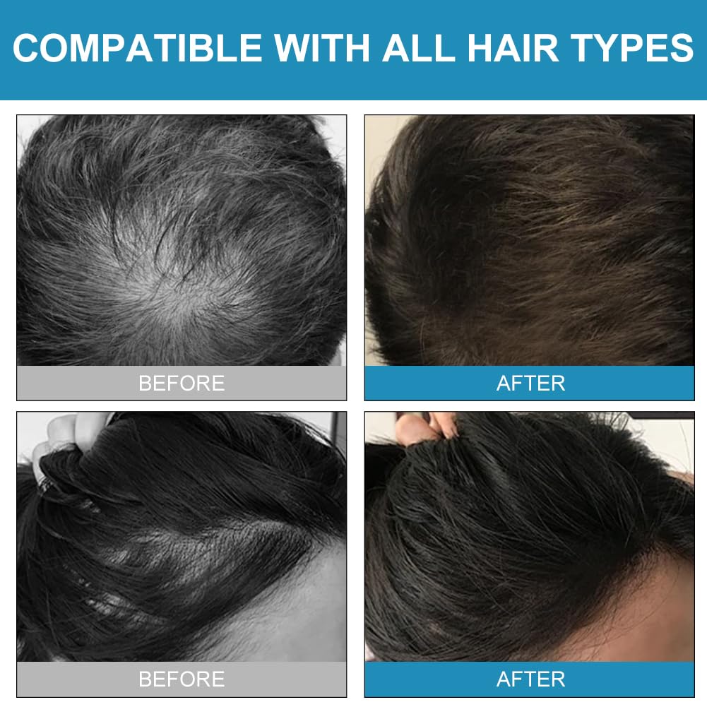 Fibres Capillaires avec Applicateur en Spray, Professionnelle Poudre Spray, Poudre de Cheveux de Qualité Professionnelle pour Hommes et Femmes, Densifier Racines(Noir)