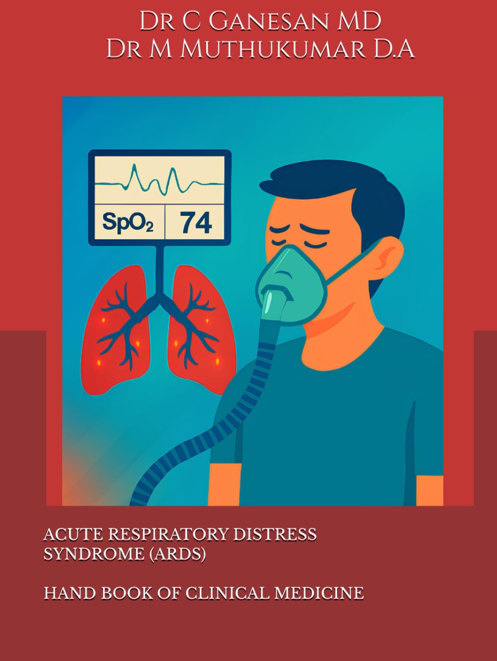ACUTE RESPIRATORY DISTRESS SYNDROME - HAND BOOK OF CLINICAL MEDICINE