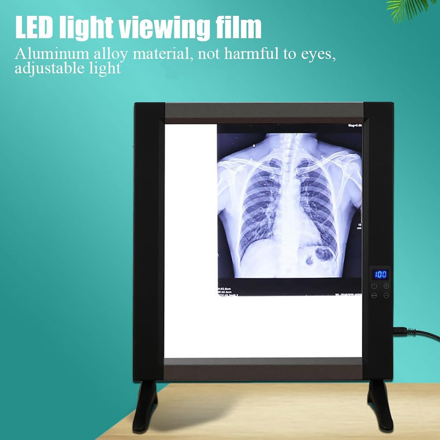 Röntgen-LED-Board-Box, Professionelle Filmbetrachtungslampe, Diabetrachter-Beleuchtung, 4500 Cd/m² Beleuchtung, 0-100% Einstellbare Helligkeit, Automatische Speicherfunktion, Keine Schatten