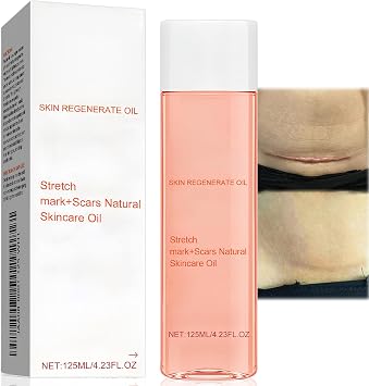 Oil Stretch Mark & Scar Treatment, Boosts Collagen, Lifts Skin, Improves Stretch Marks, Scars & Uneven Tone,125ml