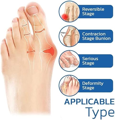 Evuru Orthopedic Compression Toe Socks, No Show Toe Socks, Full Toe Yoga Socks, Bunion Relief Socks, Orthopedic Toe Compression Sock, No Show Low Cut Five Finger Socks,B #TOP5