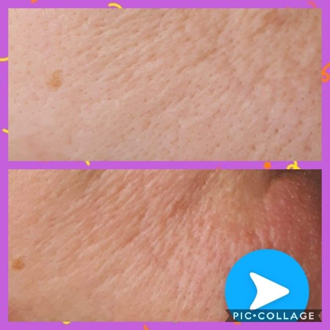 GEO Marketing Inc LLC La Roche-Posay Redermic R Anti Aging Retinol Cream, Reduces Wrinkles, Fine Lines, and Age Spots with Pure Retinol Face Cream