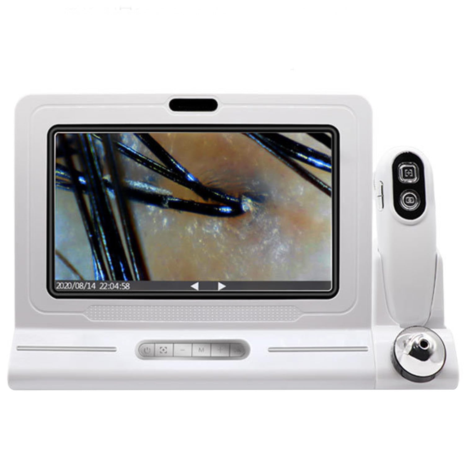 11 Zoll HD Haut- und Kopfhaut-Analysegerät, 50x/200x Vergrößerung, 4-Spektrum-Erkennung, Polarisationslicht, Haarfollikel-Detektor für Salon, Klinik und Heimgebrauch