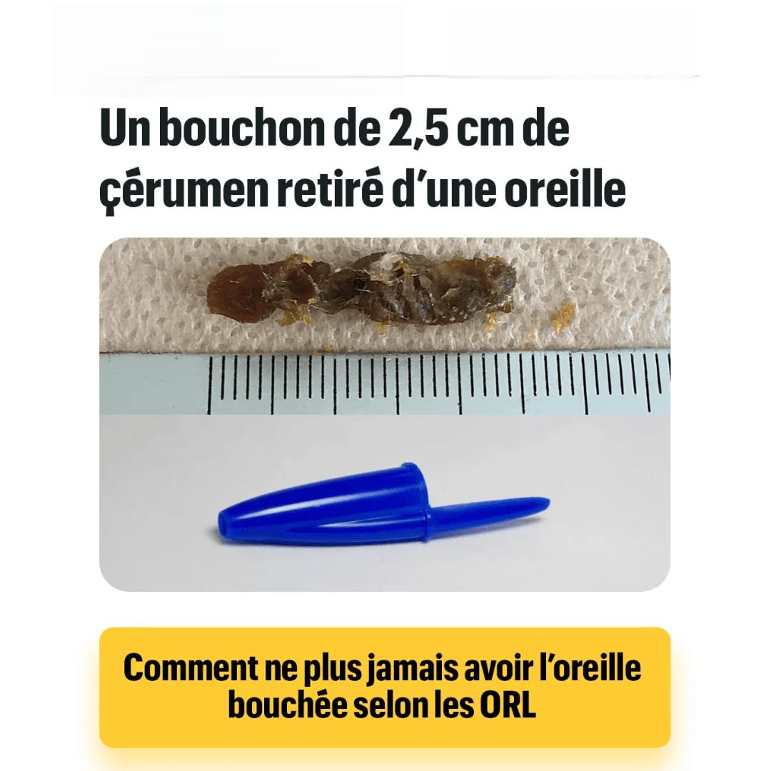 Earo Vision 1.0 - Hygiène Auditive Révolutionnée A Vie Otoscope Avec Cure Caméra Oreille 1080P HD Nettoyage, 3,5 mm Etanche, Compatible iOS et Android (noir)