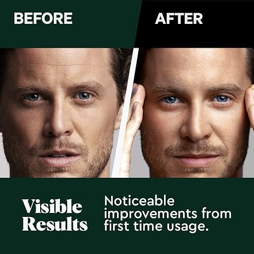 Miniatura 3 de Wolf Project - Mascarillas hidratantes para hombre mascarilla facial de carbón con ácido hialurónico vitamina B3 suero natural paquete de 8