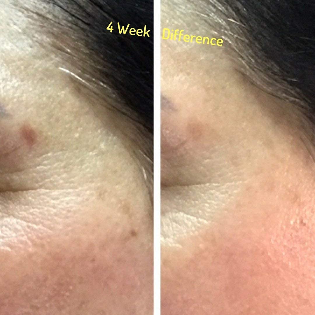 Buy Divine Derriere Dark Spot Corrector for Face and Body, Age Spot