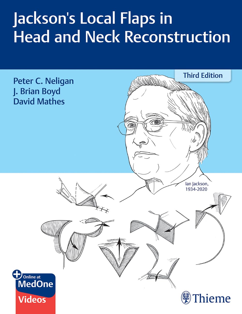Jackson's Local Flaps in Head and Neck Reconstruction | Amazon.com.br