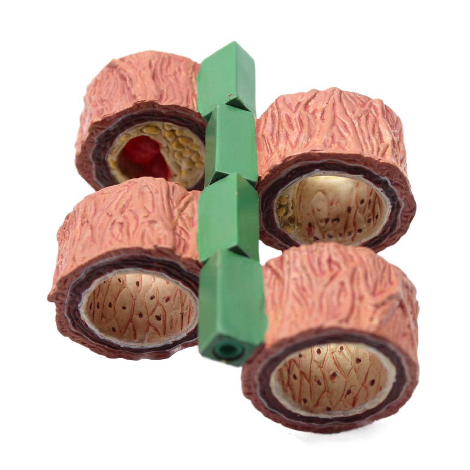 Modèle d'artère en 4 pièces, réplique de l'anatomie du corps humain de la plaque de l'artère accumule pour outil éducatif de bureau, modèle d'apprentissage médical e A