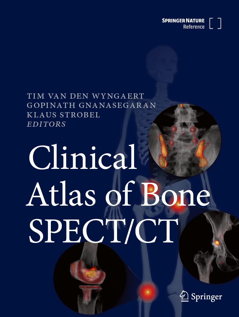 Clinical Atlas of Bone SPECT/CT: 9783031264481: Medicine & Health ...