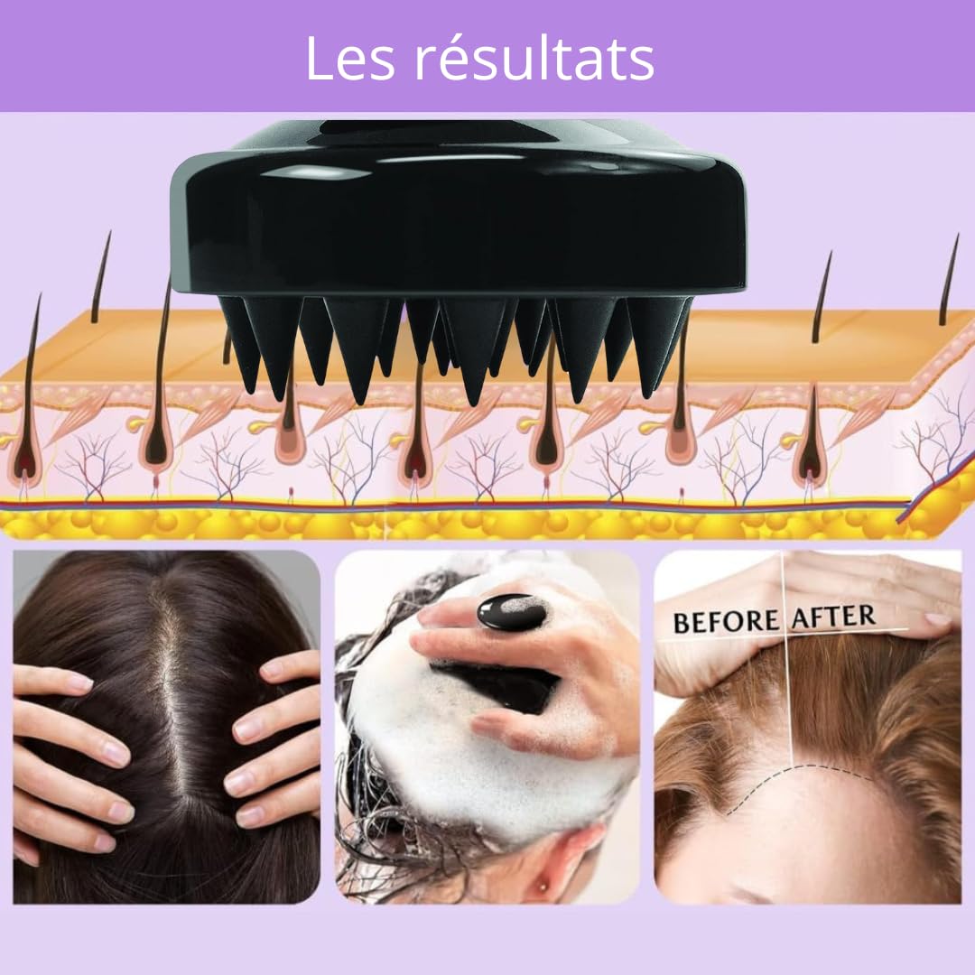 PARENCE.- Lot de 2 Brosses Massage Cuir Chevelu - Masseurs de Tête en Silicone - Cheveux Secs et Mouillés - 2 Pièces