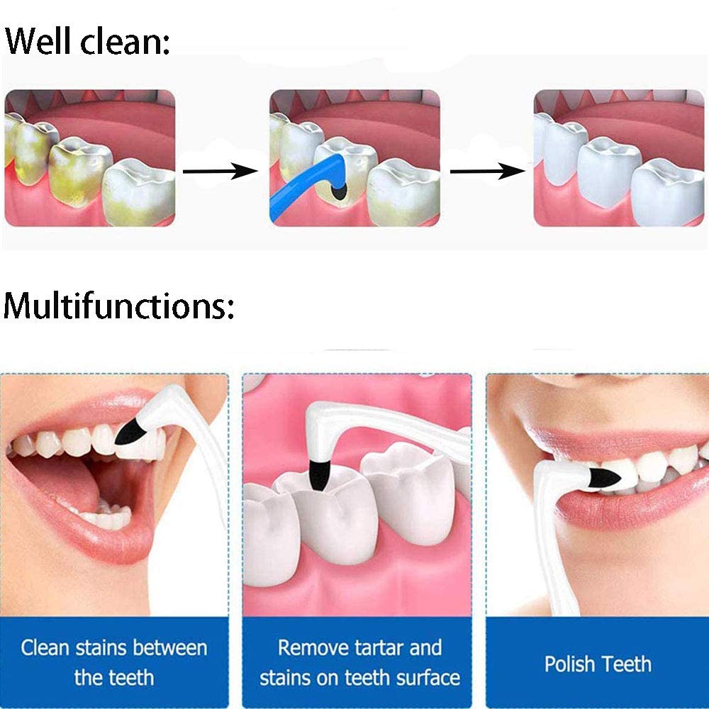 Borrador de manchas de dientes, pulido de dientes, removedor de manchas de dientes, limpieza de dientes, blanqueamiento de dientes, herramienta de cuidado de la higiene bucal para dientes, color