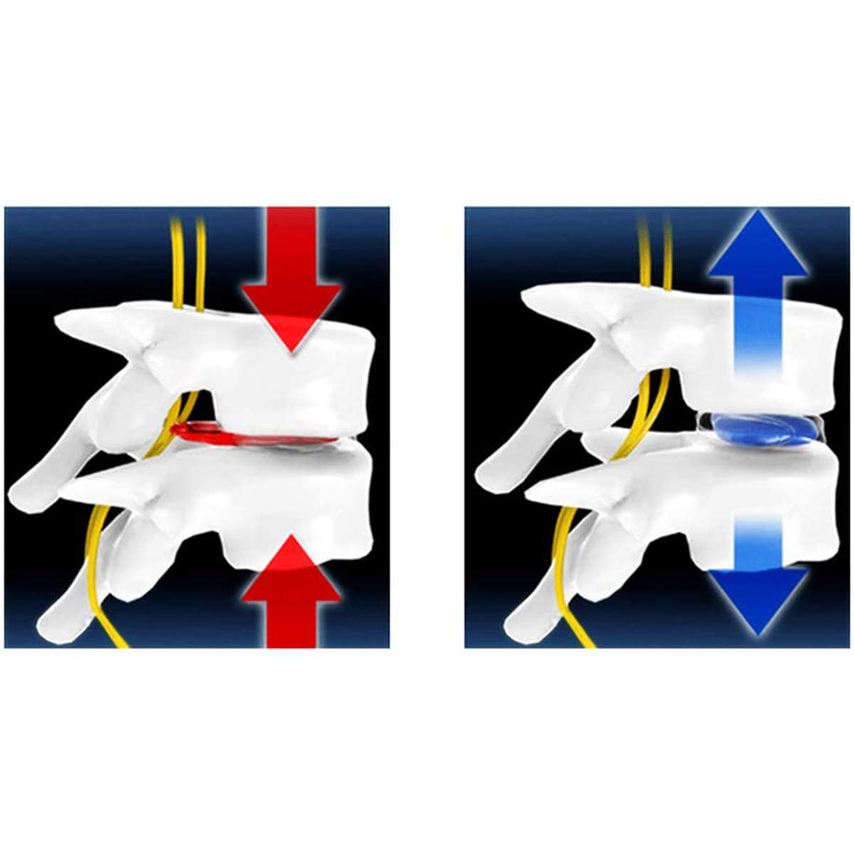 Dispositivo di trazione cervicale del Collare del Collare del Collo, Strumento di Fisioterapia, impacco Caldo, Collo Gonfiabile, Tratto di Cura Fisso