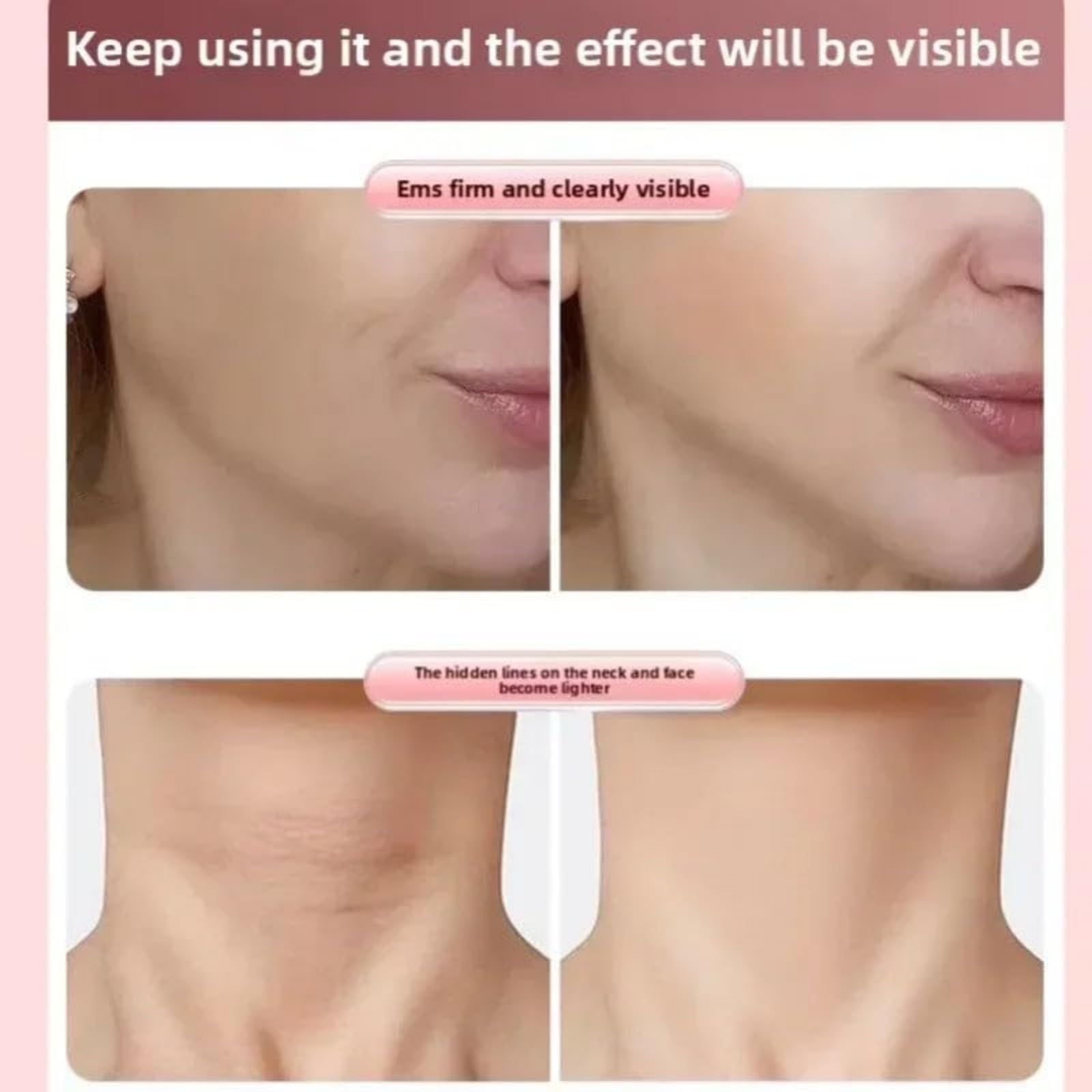 Rodillo modelador facial 3D con EMS, masajeador recargable en forma de V, herramienta de lifting facial, dispositivo portátil antienvejecimiento para aliviar la hinchazón y las arrugas (1PC)