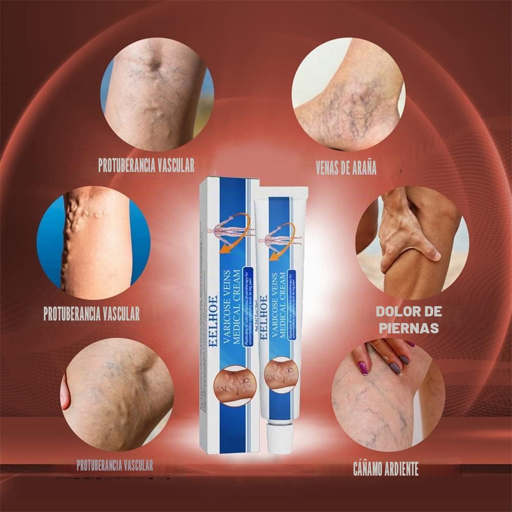 Veinshealth - Terapia de luz azul para venas varicosas (2 cremas + 1 bolígrafo)