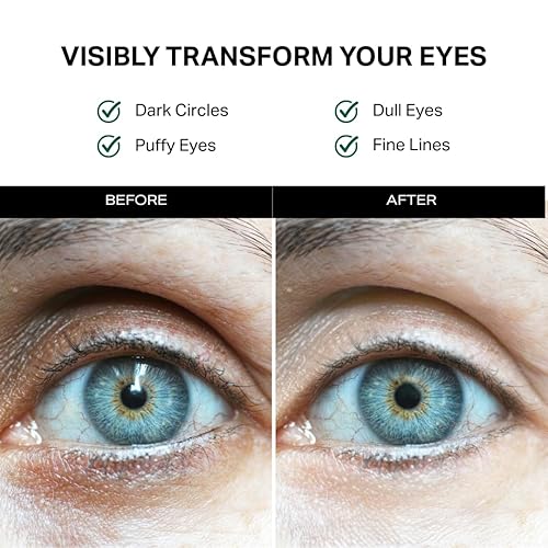 Miniatura 2 de Y'OUR Crema para ojos compleja de retinol y péptido antienvejecimiento para ojeras, hinchazón, arrugas y patas de gallo hidratante y reparación