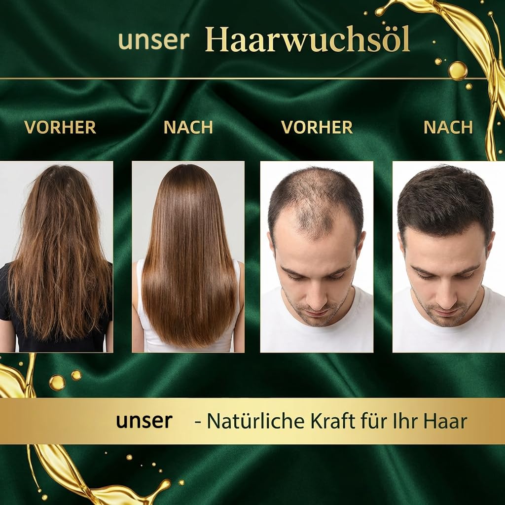 Teluni BabboSow Haaröl-Rosmarin-Haarpflege—Rosmarinöl Haarkur Für Dichtes Haar Und Gesunde Kopfhaut Reparierendes Haaröl Mit Natürlichen Inhaltsstoffen Für Glanz Und Geschmeidigkeit (3 Stück)