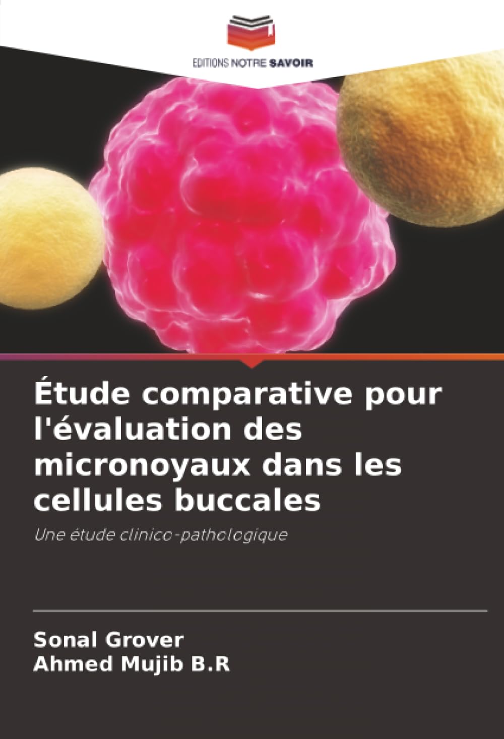 Étude comparative pour l'évaluation des micronoyaux dans les cellules buccales: Une étude clinico-pathologique