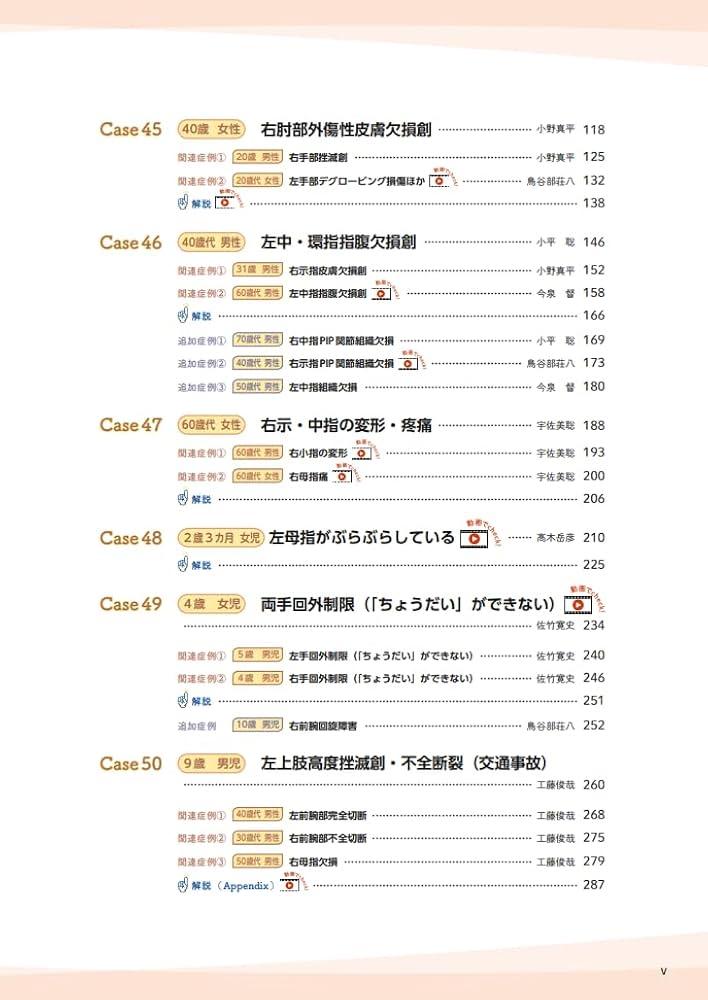 体験する手外科: 珠玉の症例編 (第4巻) | 鳥谷部荘八 |本 | 通販 | Amazon