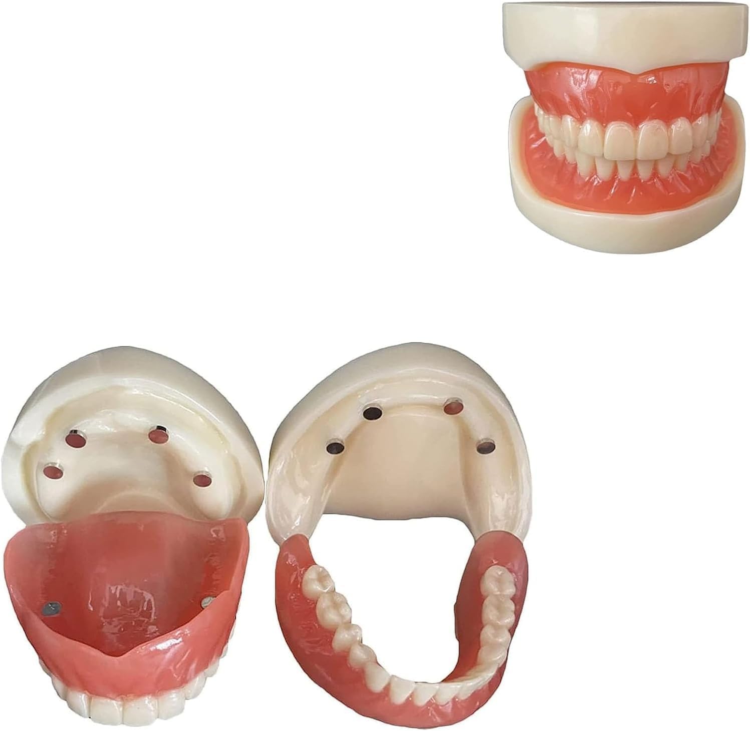 Zahnmodell, Zahnimplantatmodell, Standard-Zahnmodelle, Kunststoff-Mundmodell für zahnärztliche Bildung, Zahnpathologie-Display