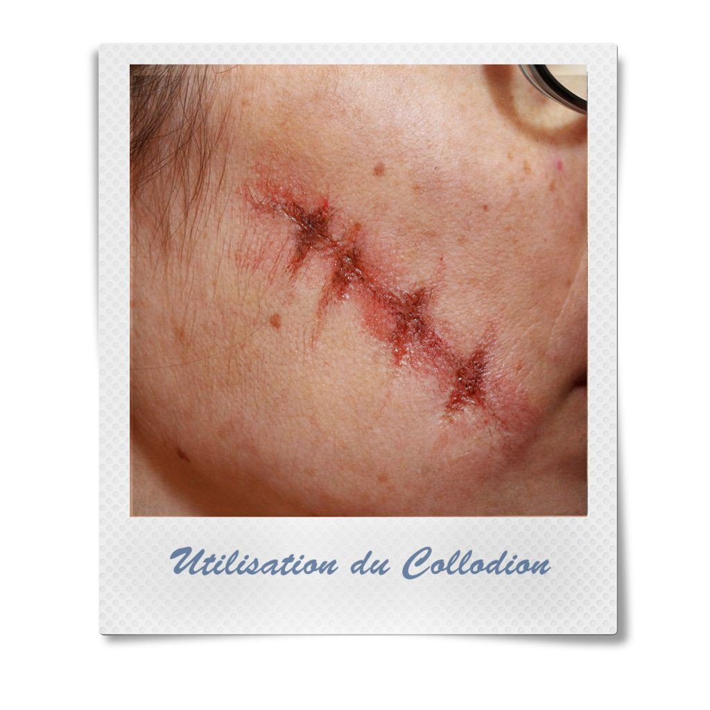 Kryolan Collodio 11 Ml