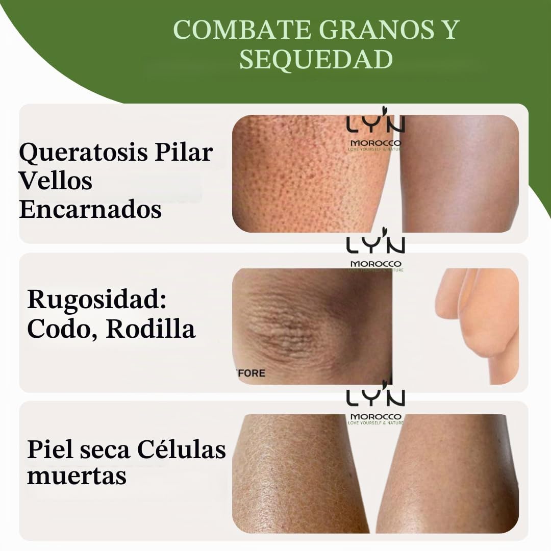 Exfoliante Corporal Brillo y Antirugosidades (Tabrima), 100%Natural y Orgánico con NILA, Oliban y Plantas-Para Queratosis, Celulitis, Desintoxicación Axilas, Antes del Bronceado y Depilación-Efectos