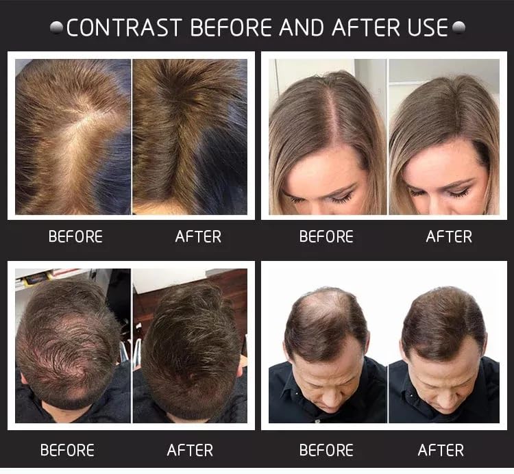 Professional Hair Fibres Powder - Instantly Conceals Thinning Hair & Bald Spots - Black, 1 g (Pack of 1) - Image 2