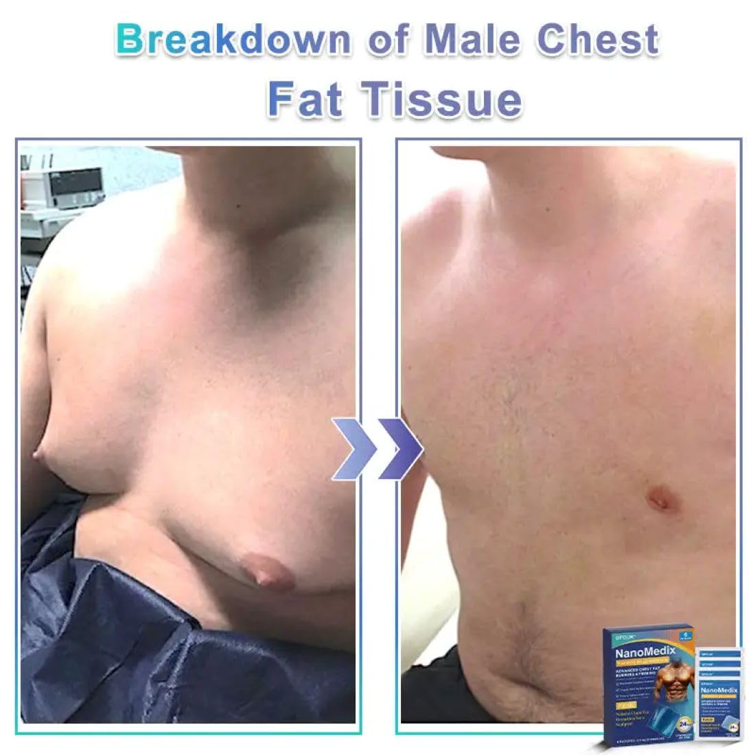 NanoMedix Gynecomastia Chest Fatburn & Firm 6 Patch for Men Chest Tightening Slimming Support Sweat Resistant Comfortable Daily Wear Patches (Pack of 1) — Amazon image 3