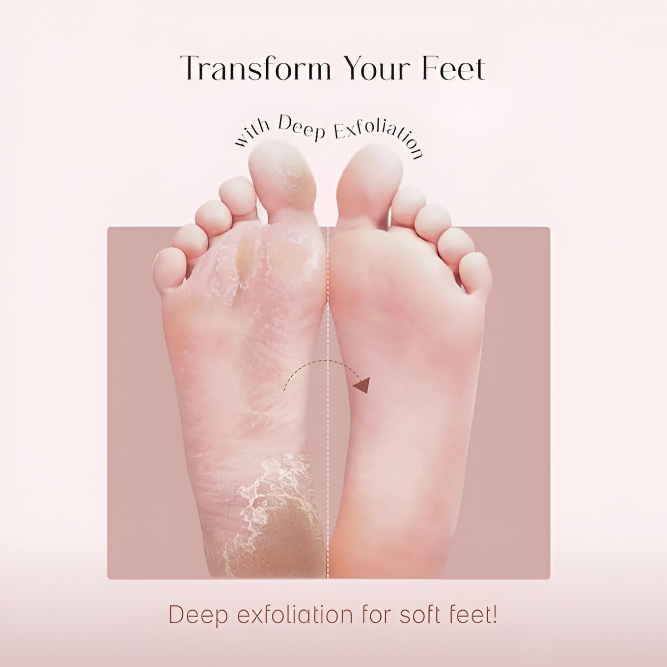 ELUYANI Lavender Foot Peeling Mask for Dead Skin Removal – Exfoliating Foot Peel Mask for Soft Smooth Feet, Callus Remover Foot Mask, Lavender Foot Spa Treatment for Dry Cracked Heels (1 Pair) 2